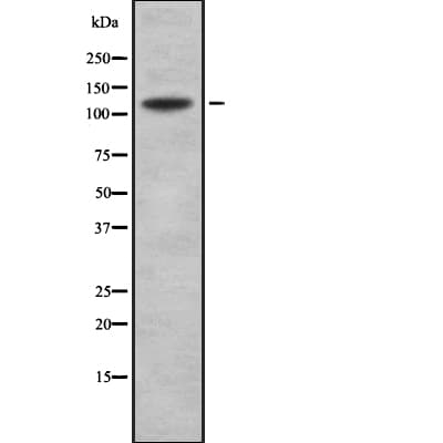 COL19A1 / Collagen XIX Antibody