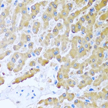 CCL8 / MCP2 Antibody