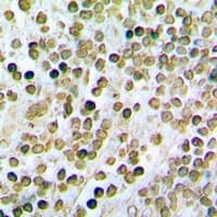 Polyclonal Rabbit anti-Human STAMBP / AMSH Antibody (IHC, IF, WB)