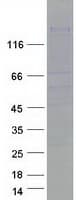 Human SPAG5 / MAP126 Protein (Recombinant Myc-DDK (Flag))