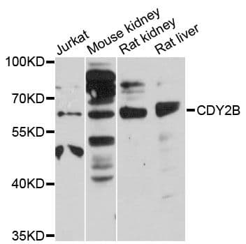 CDY2B Antibody