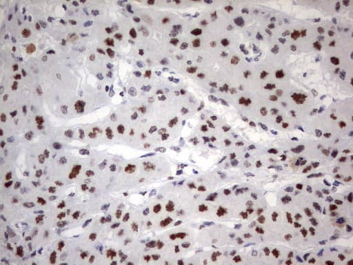 PARN Antibody (aa1-266, clone UMAB143)