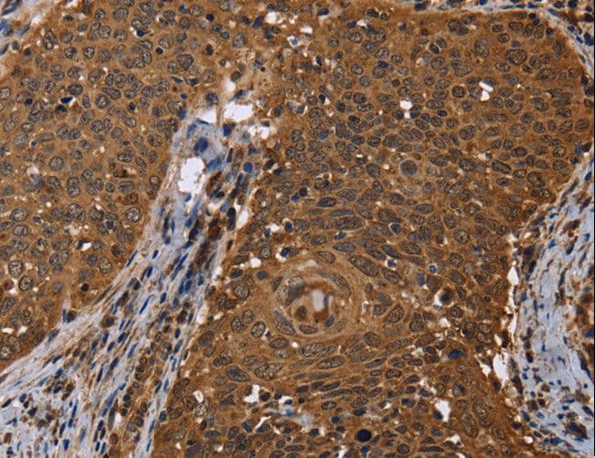 SMIF / DCP1A Antibody