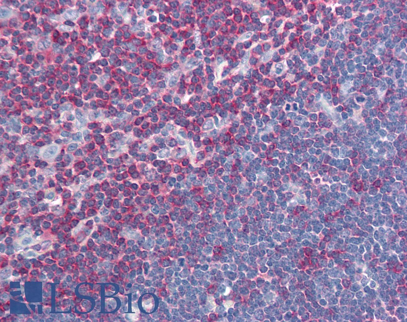 IHC-plus™ Monoclonal Mouse anti-Human LCP2 / SLP-76 Antibody (clone SLP-76/03, aa216-434, IHC, WB)