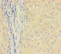 Polyclonal Rabbit anti-Human TXNDC8 Antibody