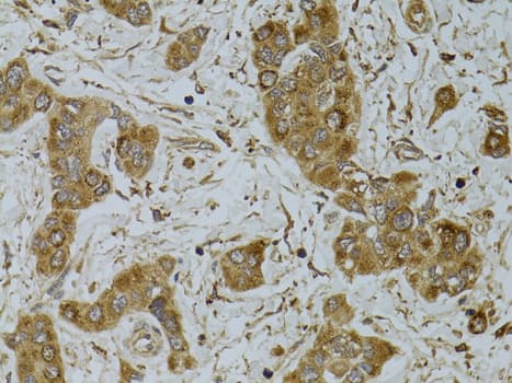 TNFSF13 / APRIL Antibody