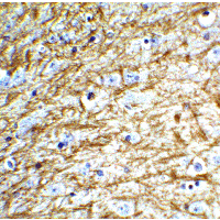 CLU / Clusterin Antibody