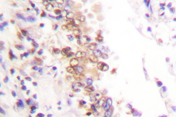 Polyclonal Rabbit anti-Human PIAS1 Antibody (Gly24, IHC, WB)