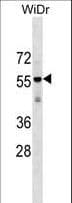 AGPAT9 / MAG1 Antibody (aa194-222)