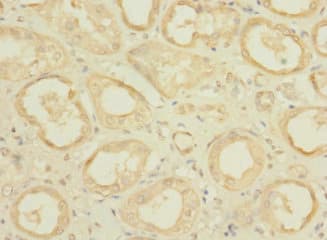 CCDC37 Antibody