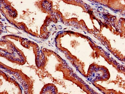 NXF5 Antibody