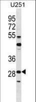 Polyclonal Rabbit anti-Human FOSL2 / FRA-2 Antibody (aa220-248, IF, WB)