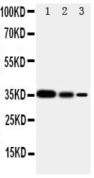 SMAD2 Antibody (aa94-112)