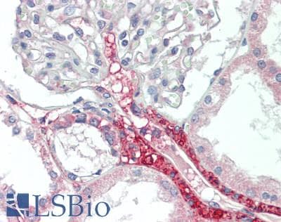 IHC-plus™ Polyclonal Rabbit anti-Human WNK1 Antibody (aa1625-1675, IHC, WB)