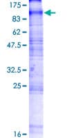 Human SLC20A2 / PIT2 Protein (Recombinant GST)