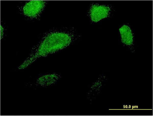 Monoclonal Mouse anti-Human GLE1 Antibody (clone 1D8, IF, WB)