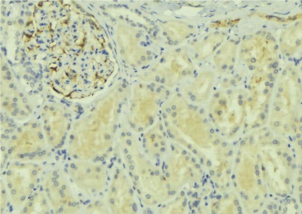 Raptor / Mip1 Antibody