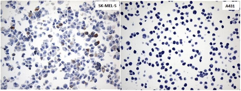 Tyrosinase Antibody (aa19-320, clone UMAB257)