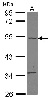 Polyclonal Rabbit anti-Human TBC1D10C / CARABIN Antibody (WB)