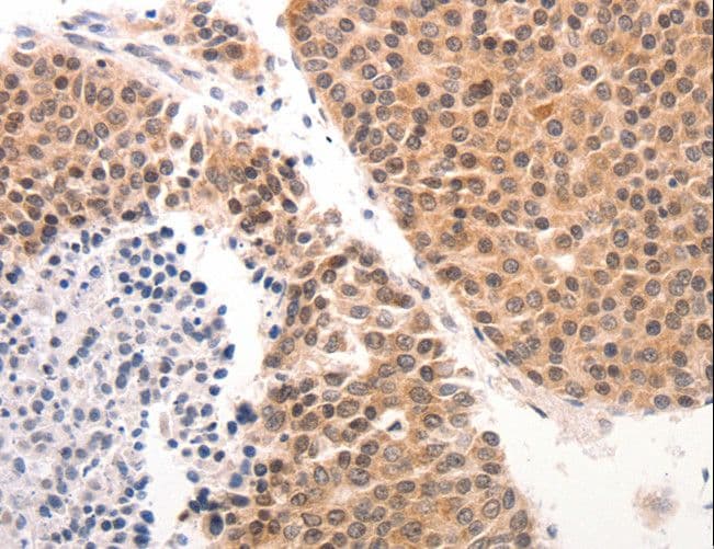 KRT6 / CK6 / Cytokeratin 6 Antibody