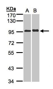 IL12RB2 Antibody (aa323-695)