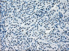 CRYAB / Alpha B Crystallin Antibody (clone OTI6A9)