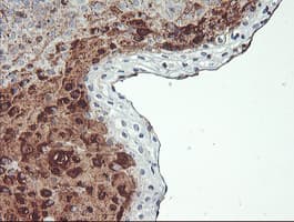 SCHIP1 Antibody (clone OTI1C8)
