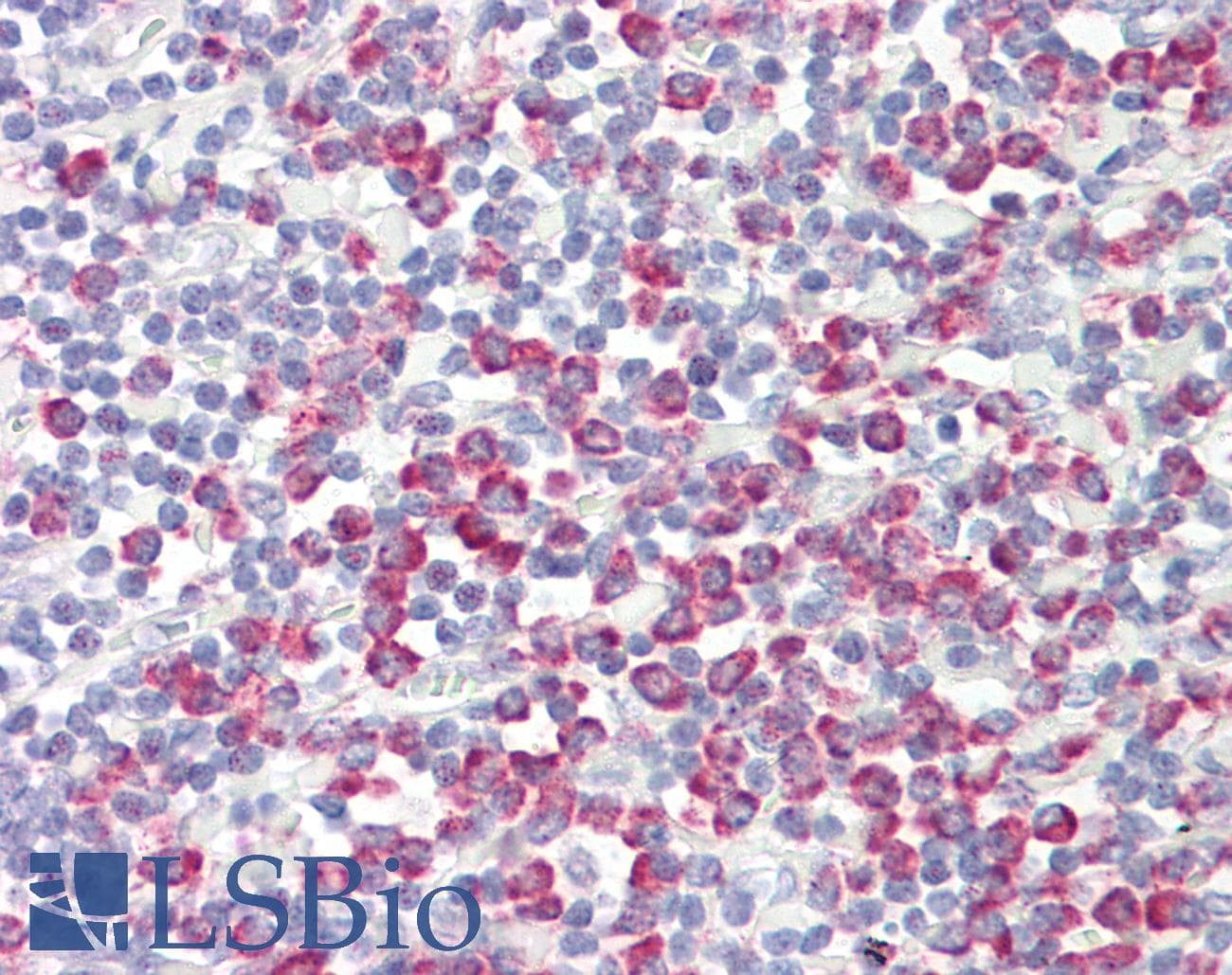 IHC-plus™ ATP5G2 Antibody (aa1-50)