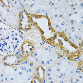 SLC4A5 / NBC4 Antibody