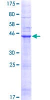 Human LHFP Protein (Recombinant GST)