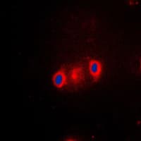 CYP2J2 Antibody (Internal)
