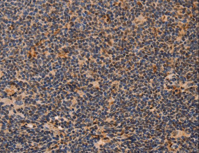 Polyclonal Rabbit anti-Human MPG Antibody (IHC, WB)