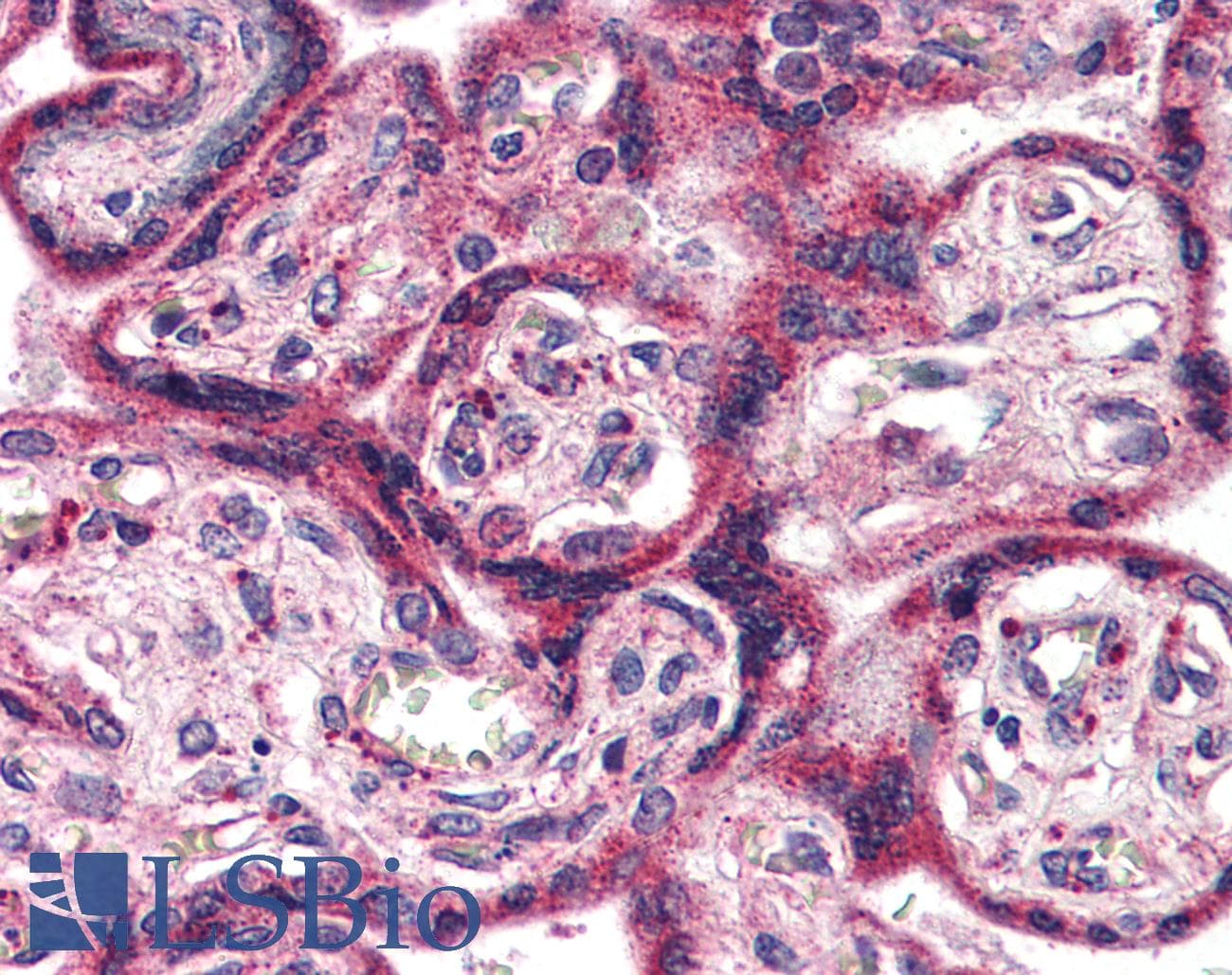 IHC-plus™ Polyclonal Rabbit anti-Human EPHX2 / Epoxide Hydrolase 2 Antibody (C-Terminus, IHC)