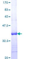 Human PTCH1 / Patched 1 Protein (Recombinant GST, N-terminus)