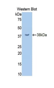 CD45 / LCA Antibody (aa644-900, Cy3)