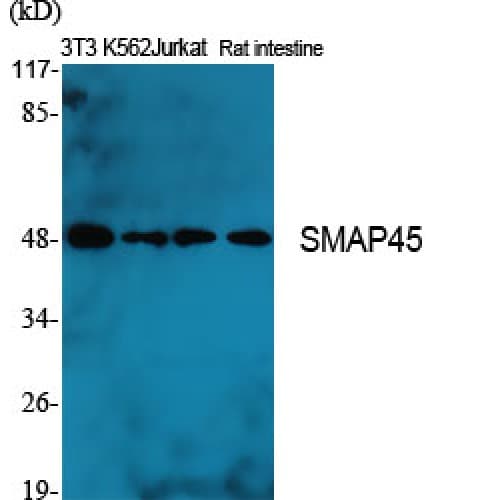Polyclonal Rabbit anti-Human HDAC3 Antibody (350-430 aa, C-terminal, IHC, IF, WB)