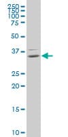 HOXB9 Antibody (clone 3C8)