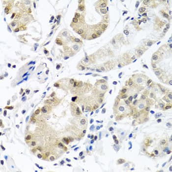 Polyclonal Rabbit anti-Human HnRNP-E1 / PCBP1 Antibody (IHC, IF, WB)