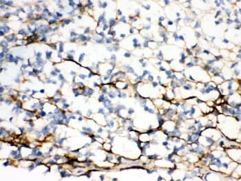 VCAN / Versican Antibody