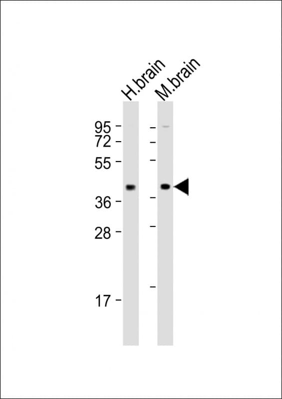 Polyclonal Rabbit anti-Human SH3GL3 Antibody (aa290-325, WB)