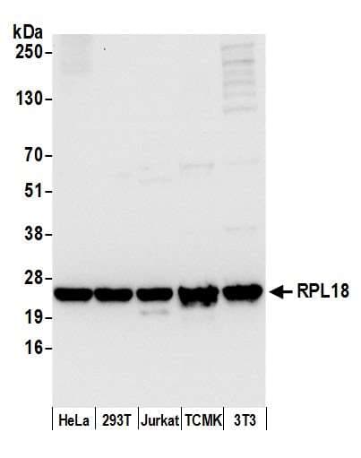 Polyclonal Rabbit anti-Human RPL18 / Ribosomal Protein L18 Antibody (aa1-50, WB)