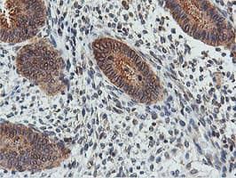 Monoclonal Mouse anti-Human FDFT1 / Squalene Synthase Antibody (clone OTI2F10, IHC, IF, WB)