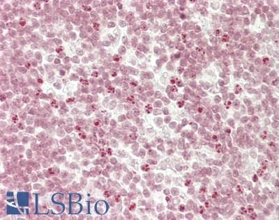 IHC-plus™ Polyclonal Rabbit anti-Human ETV6 / TEL Antibody (aa202-251, IHC, WB)