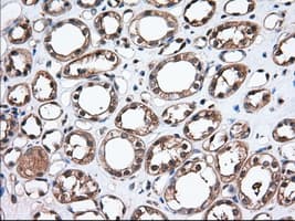 TS / Thromboxane Synthase Antibody (clone OTI2C1)