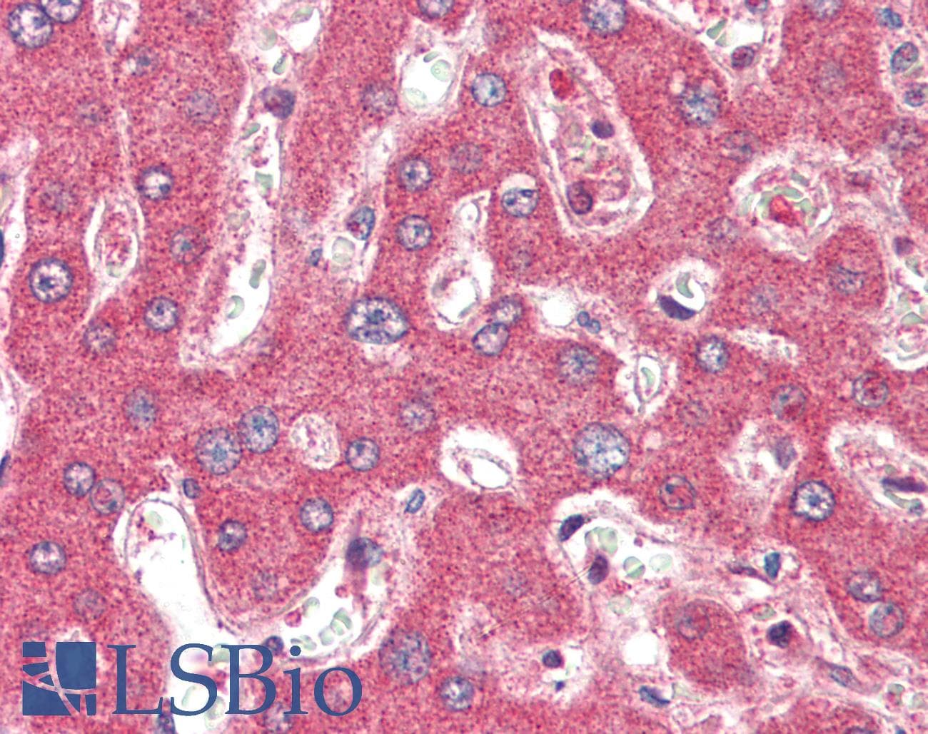 Polyclonal Rabbit anti-Human TSLP Antibody (IHC, IF, WB)