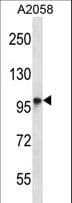 Polyclonal Rabbit anti-Human TMC6 Antibody (aa160-188, WB)
