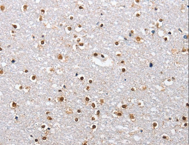 Polyclonal Rabbit anti-Human ELAVL1 / HUR Antibody (IHC, WB)