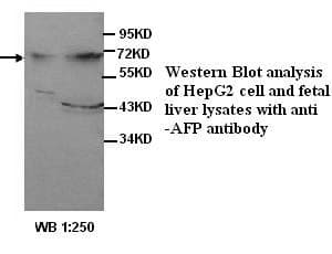IHC-plus™ Polyclonal Rabbit anti-Human Alpha-Fetoprotein Antibody (Internal, IHC, WB)
