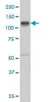 EPHB3 / EPH Receptor B3 Antibody (clone 1E12)