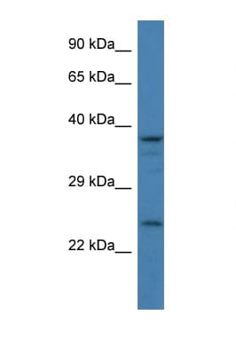 GAP43 Antibody (C-Terminus)